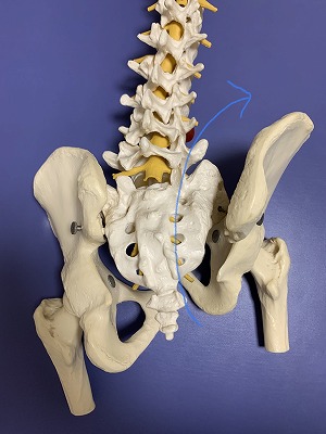 右腸骨前上方変位骨盤