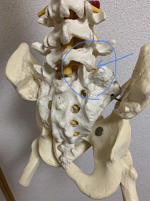 腰椎　右方変位